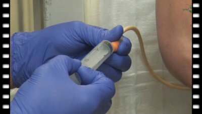 Методика выполнения антеградной пиелоуретероцистографии