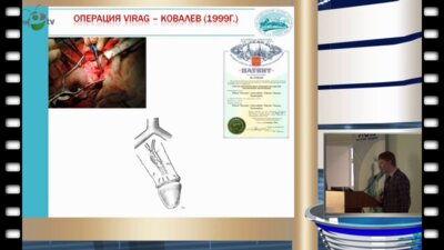 Кызласов П.С. - Новый подход к ведению пациентов после реваскуляризации полового члена