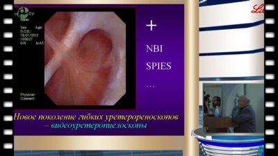 Мартов А.Г. - Инновации в эндоурологии