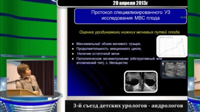 Дерюгина Л.А. "Разработка специализированного ульразвукового протокола Экспертного исследования мочевыделительной системы плода"