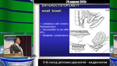 S. Tekgul ""Neurogenic bladder. Augmentation/Diversion"