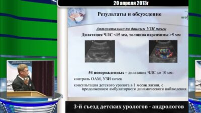 Баранов Ю.В. "Тактика наблюдения детей с пренатально установленным диагнозом Врожденный гидронефроз"