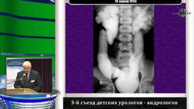 Чумаков П.И. "Антирефлюксная защита почки при обструкции мочеточника"