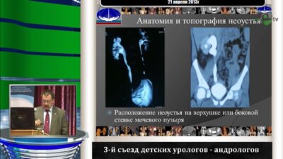 Павлов А.Ю. "Заболевания уретеро-везикального соустья новые технологии диагностики и выбор метода лечения"