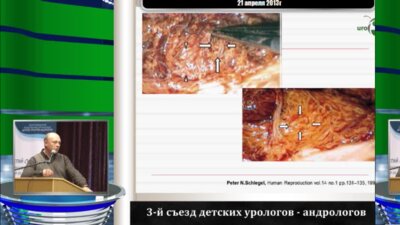 Боголюбов "С.В. Новые подходы к лечению бесплодия при синдроме Кляйнфельтера"