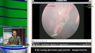 Игнатьев Р.О. "Особенности пневмовезикоскопической уретероцистонеостомии"