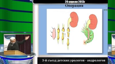 Коган М.И. "От противоречивых суждений к расширению знаний в детской и взрослой урологии"