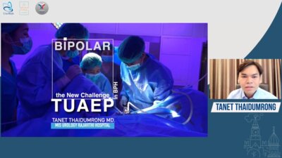 Tanet Thaidumrong - Transurethral anatomical enucleation of prostate (TUAEP). The new challenge in BPH