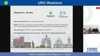 Панфёров А.С. - Перкутанная нефролитотомия слева