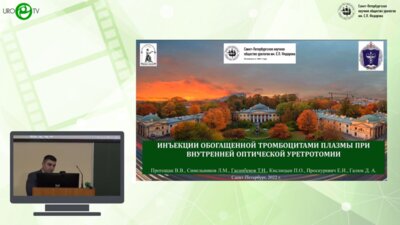 Гасанбеков Т.Н. - Инъекции обогащенной тромбоцитами плазмы при внутренней оптической уретротомии
