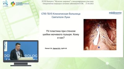 Орлов И.Н. - YV-пластика при стенозе шейки мочевого пузыря. Кому и как?