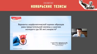 Кривоносов Д.И. - Варианты морфологической оценки образцов рака ПЖ у мужчин молодого (до 50 лет) возраста