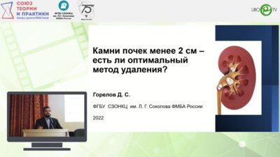 Горелов Д.С. - Камни почек менее 2 см - есть ли оптимальный метод удаления?