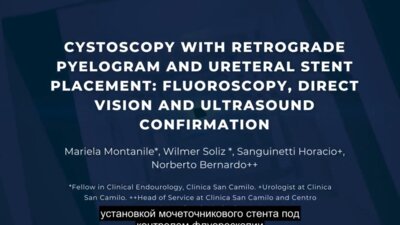 Цистоскопия с ретроградной пиелографией и установкой мочеточникового стента (Core Videos (2024): Cystoscopy with Retrograde Pyelogram and Ureteral Stent Placement)