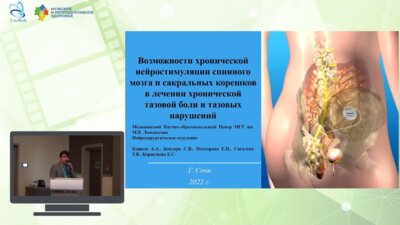 Кащеев А.А. - Возможности хронической нейростимуляции спинного мозга и сакральных корешков в лечении хронической тазовой боли и тазовых нарушений