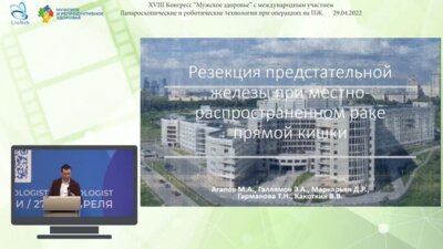 Агапов М.А. - Резекция предстательной железы при местно-распространенном раке прямой кишки