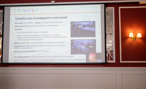 Третий урологический мотопробег — Научный мост Москва-Вологда-Москва