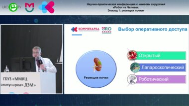 Кобзев Д.С. - Место ретроперитонеоскопического доступа при резекции почки