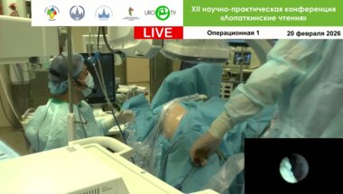 Комбинированная эндоскопическая интраренальная хирургия. Операторы Акопян Г.Н., Панферов А.С.