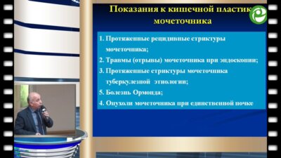 Гулиев Б.Г. - Лапароскопическая кишечная и аппендикулярная пластика мочеточников