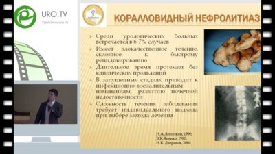 Амосов Н.А. - Рентгенэндоскопические операции в лечении больных коралловидным нефролитиазом