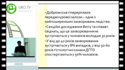 Головко С. - Селективная артериальная эмболизация как малоинвазивный метод лечения ДГПЖ у больных с высоким оперативным риском