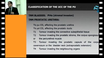 Rodrguez Faba - Prostate and upper urinary tract involvment by urothelial carcinoma
