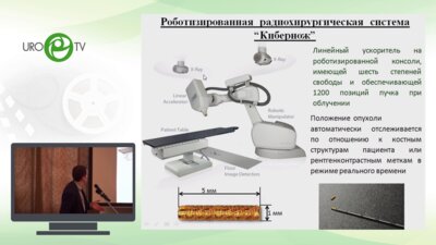 Воробьёв Н.А. - Кибернож в лечении локализованного РПЖ