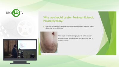 Волкан Тугчу - Промежностная РПЭ