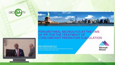 Валензуэла Р. - Периуретральный нейролизис при фаллопротезировании при лечении сопутствующей преждевременной эякуляции