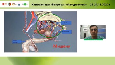 Касян Г.Р. - Сакральная нейромодуляция при идиопатических формах нарушения акта мочеиспускания