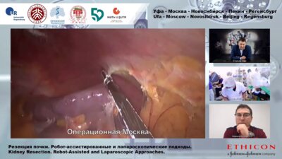 Э.А. Галлямов - Лапароскопическая резекция почки.