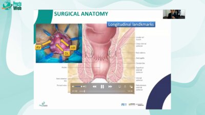 Quentin Denost - ISR and Anatomy of the Anal Canal