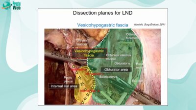 Tsuyoshi Konishi - Combined Resection of the Vessels, Nerves