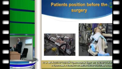 Бактимиров "Осложнения  лапароскопических операций в урологии"