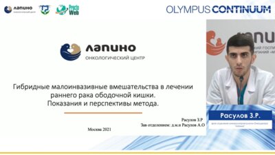 Расулов З.Р. - Гибридные малоинвазивные вмешательства в лечении рака ободочной кишки. Показания и перспективы метода